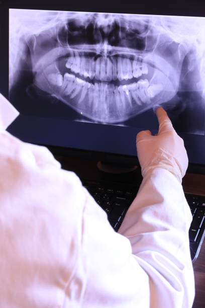 Best Holiday Emergency Dentist in Red Bank, SC