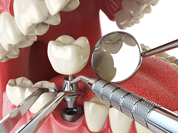 Best Mobile Emergency Dentist in Red Bank, SC